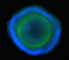 Foraminifera with fluorescent stains